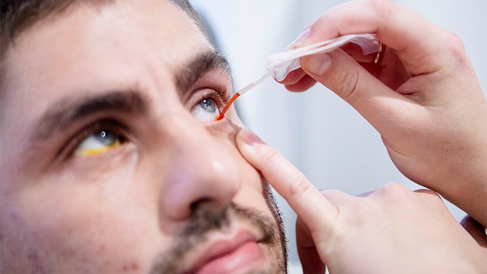 Optometrist putting iodine eye drops into patients' eyes